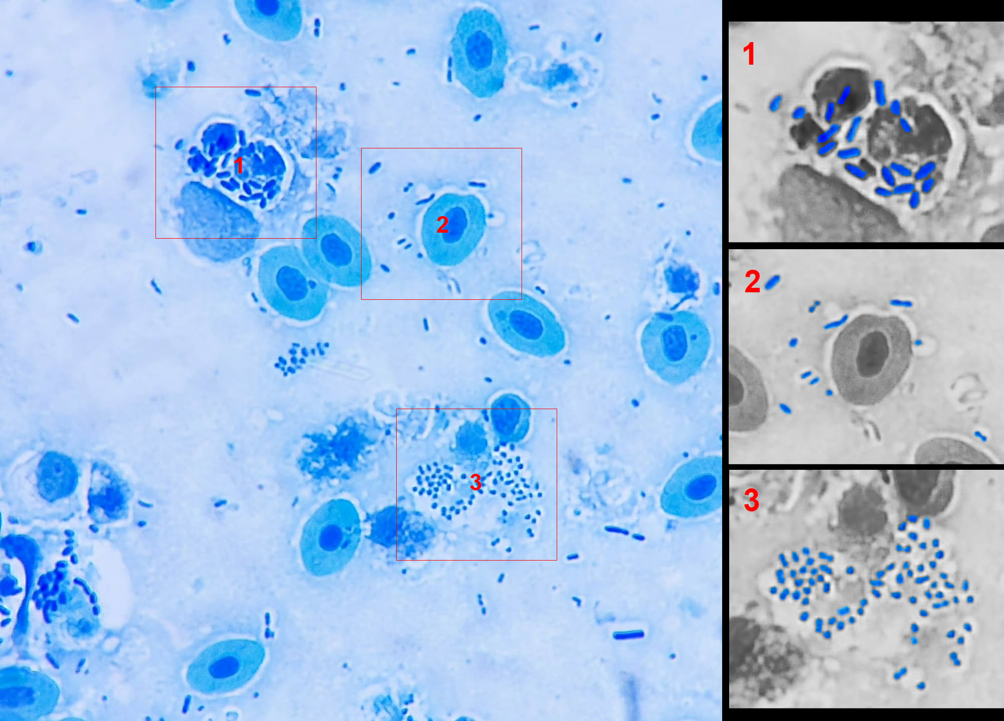 Polymicrobial field
