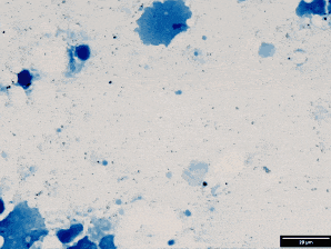 Mycobacteria, unstained