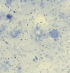 Bacterial mess