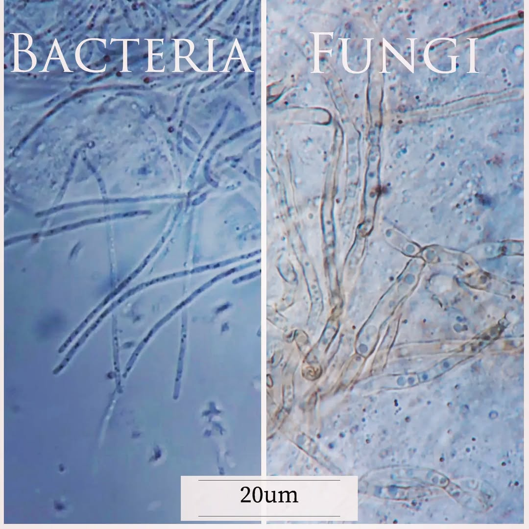 Fungi vs bacteria