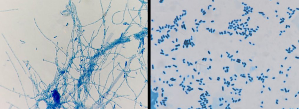 Bacteria associated with fish diseases