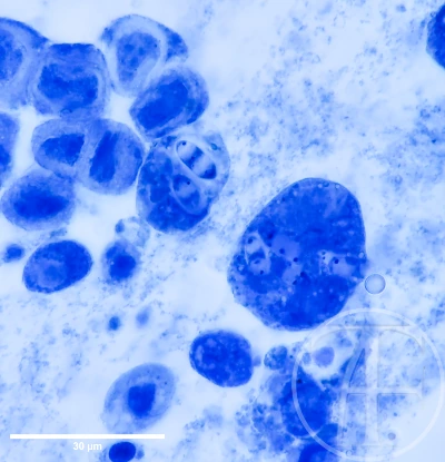 Spores. Löffler’s methylene blue (native).