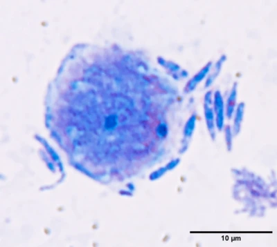 Spores. May–Grünwald stain.