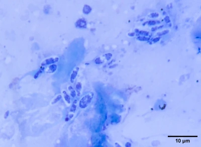 Spores. May–Grünwald stain.