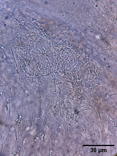 Mycelial structures in native preparation.