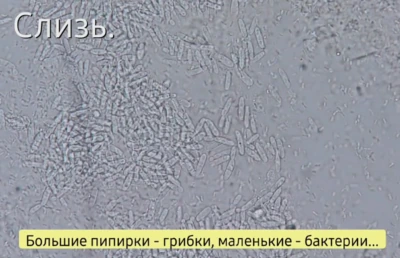Spores in mucus from internal organs.