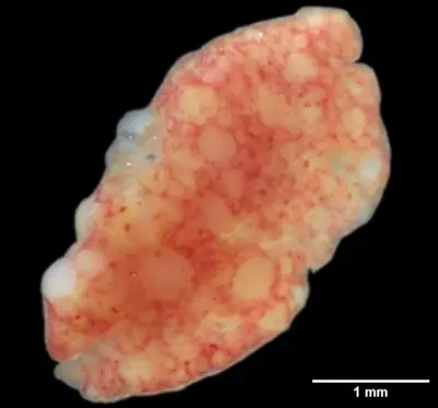 Granulomas in the spleen of Chromis viridis.