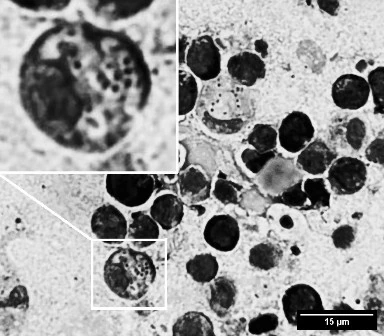 Inclusions in histiocytes of Acanthurus leucosternon spleen.