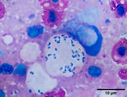 Clusters of organisms with basophilic horseshoe-like structures.