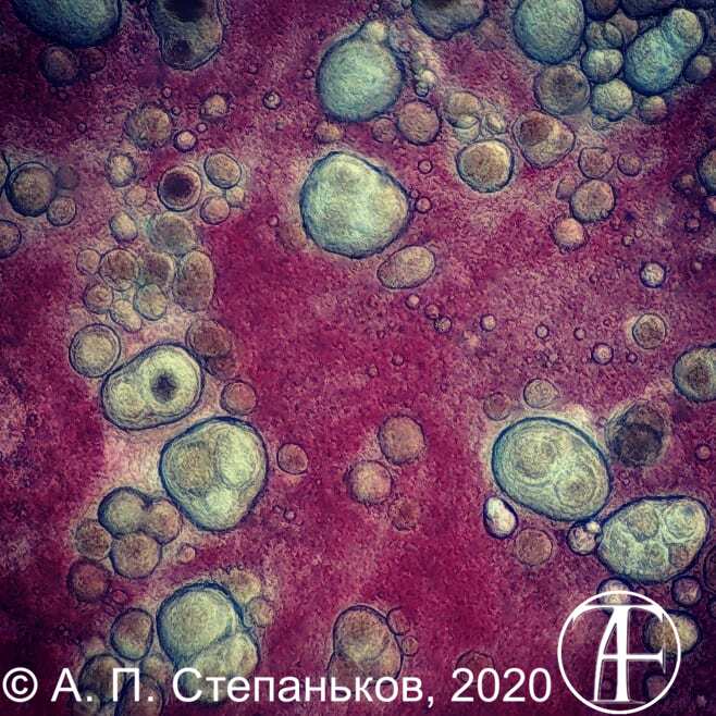 Typical granulomas associated with mycobacteriosis.