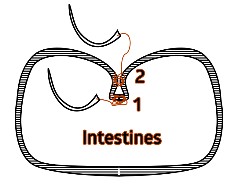 Invaginating suture