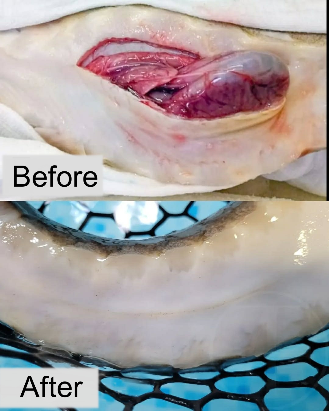 Scar after one year