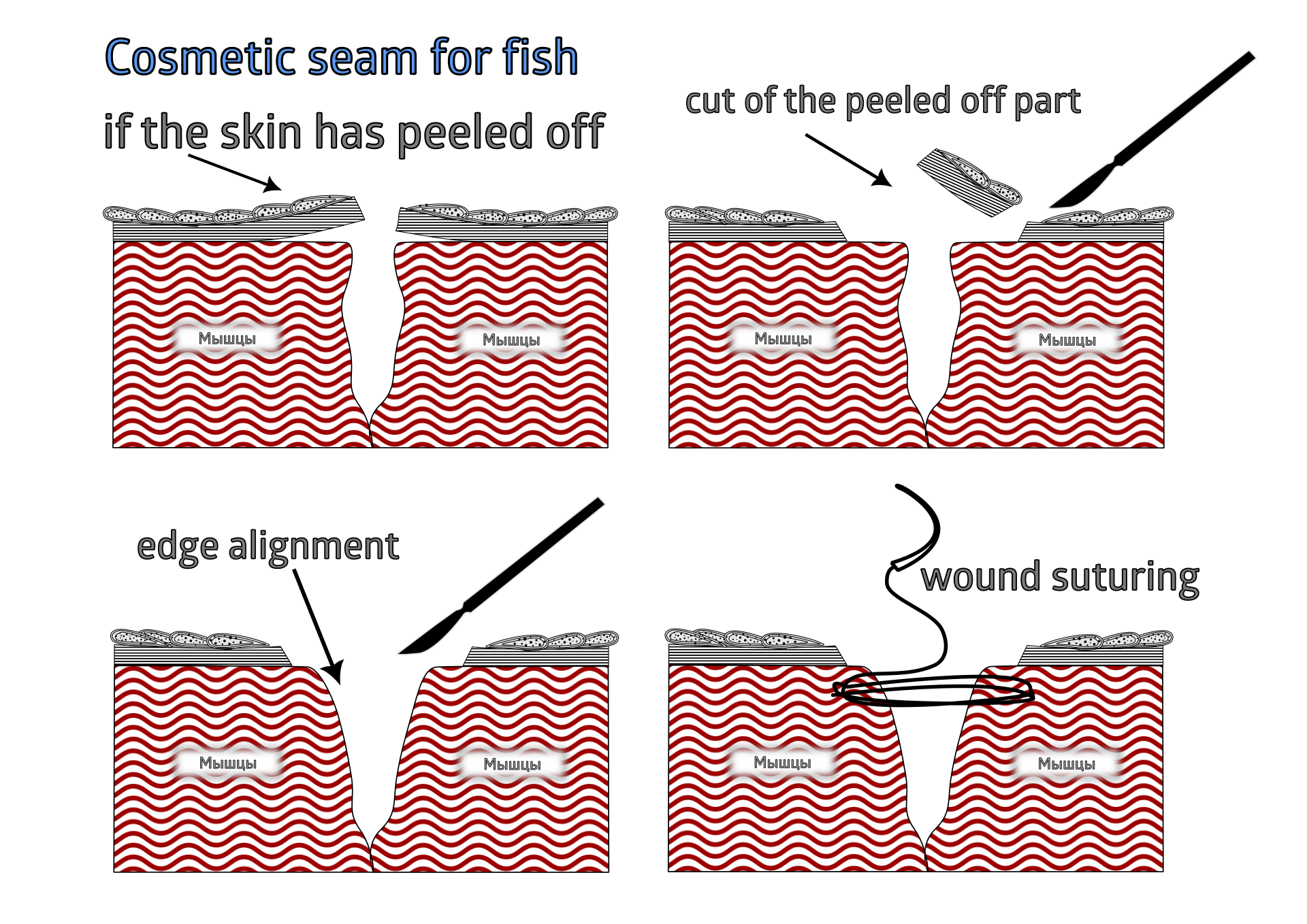 Tissue preparation and cosmetic suturing
