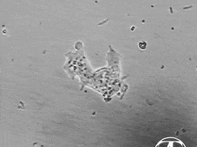 Amoeba from a seahorse