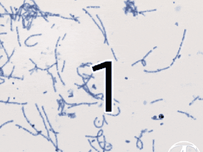 Bacteria - stained and native