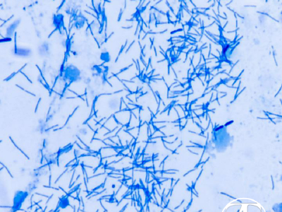 Bacteria on the wound