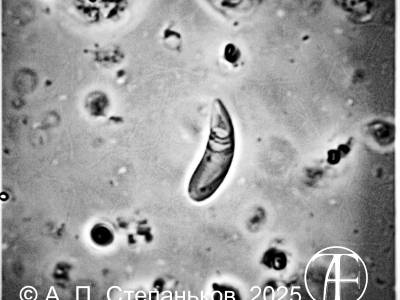 Стрекательная капсула в коралловых полипах — книдоцит