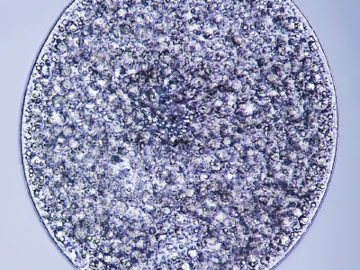 Cryptocaryon irritans