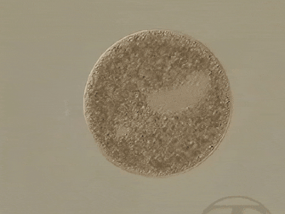 Ichthyophthirius multifiliis