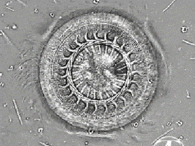 Parasitic ciliate Trihodina