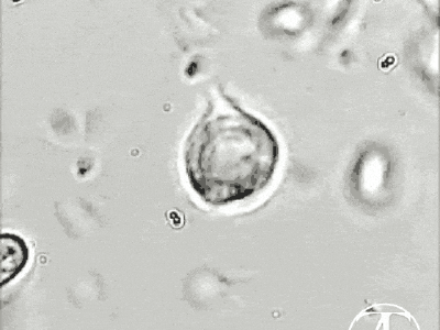 Trichomonas