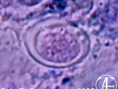 Криптоспоридии (Cryptosporidium)