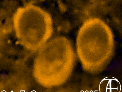 Криптоспоридии (Cryptosporidium)