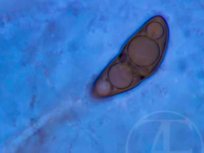 Fungal spore - Conidia