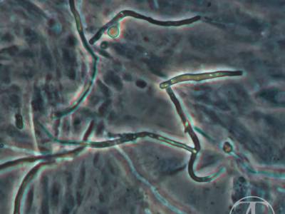 Coenocyte hyphae. Intestine