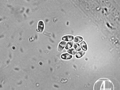 Microsporea. Microsporidia