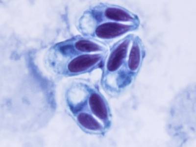 Microsporea. May-Grunwald's stain
