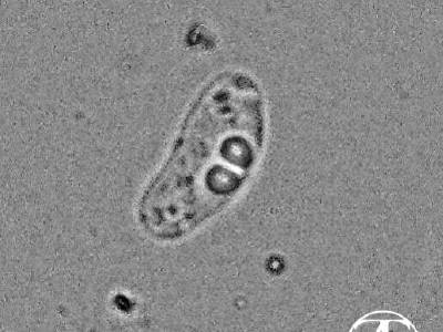 Microsporea. Spore