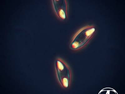 Microsporea. Spore