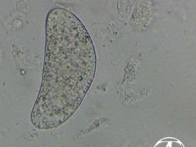 Egg of a monogenean of the genus Dactylogyrus