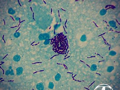 Mycobacteria. Ziehl's stain