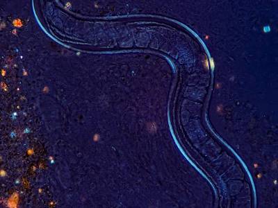 Нематода. Кишечник