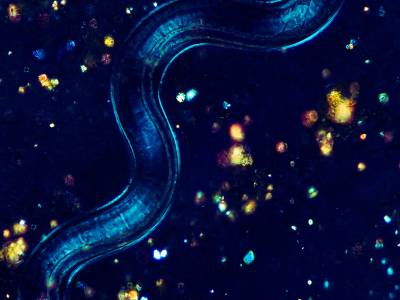 Нематода. Кишечник