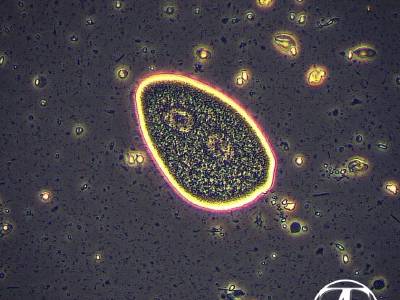 Opalina genus Zellerialla