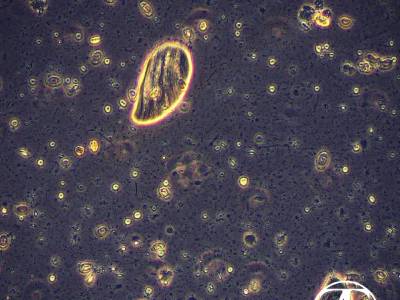 Opalina genus Zellerialla