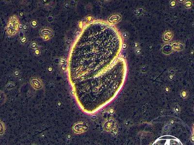 Opalina genus Zellerialla