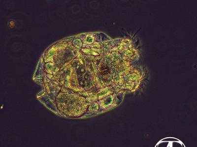 Rotifer. Phase contrast