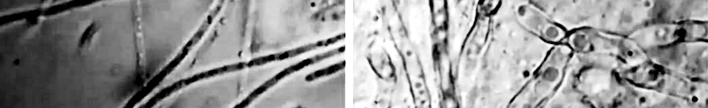 Microscopy of smears vs bacterial cultures