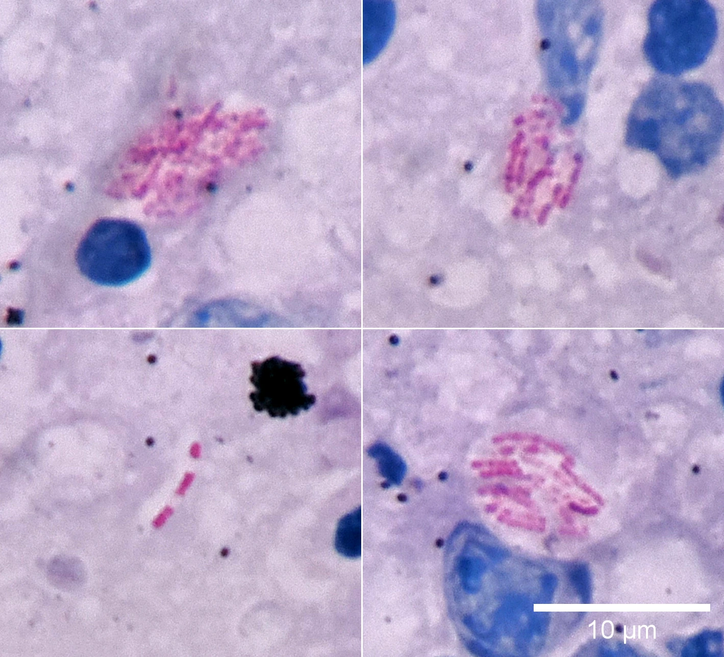 Red rod-shaped bacteria: staining with phenol and acid decolorization.