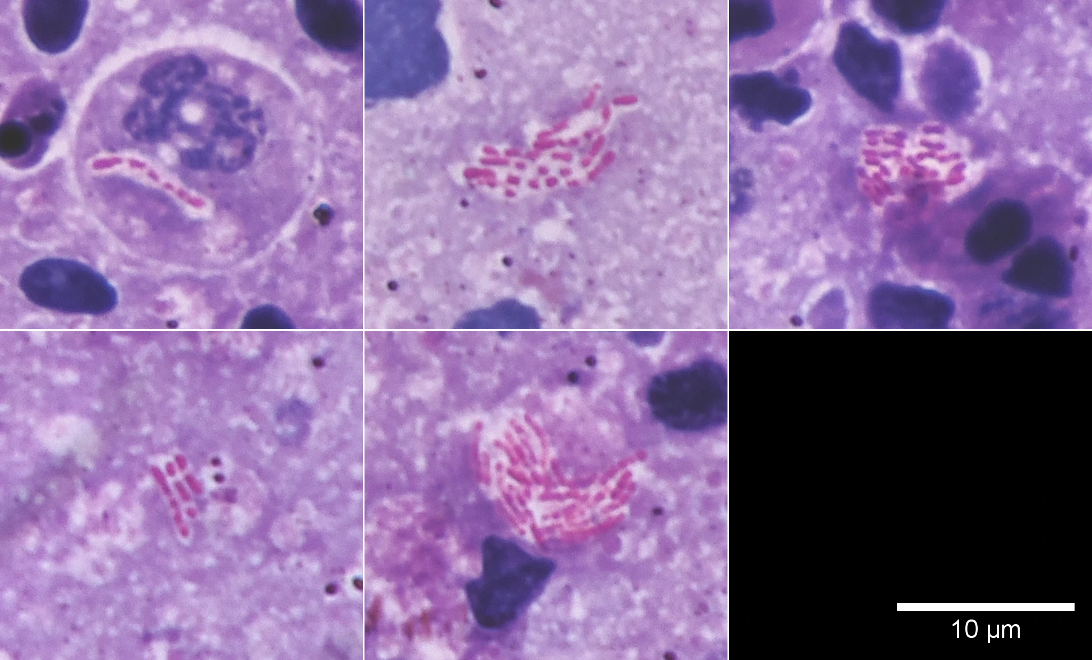 Red rod-shaped bacteria: staining without phenol or acid decolorization.