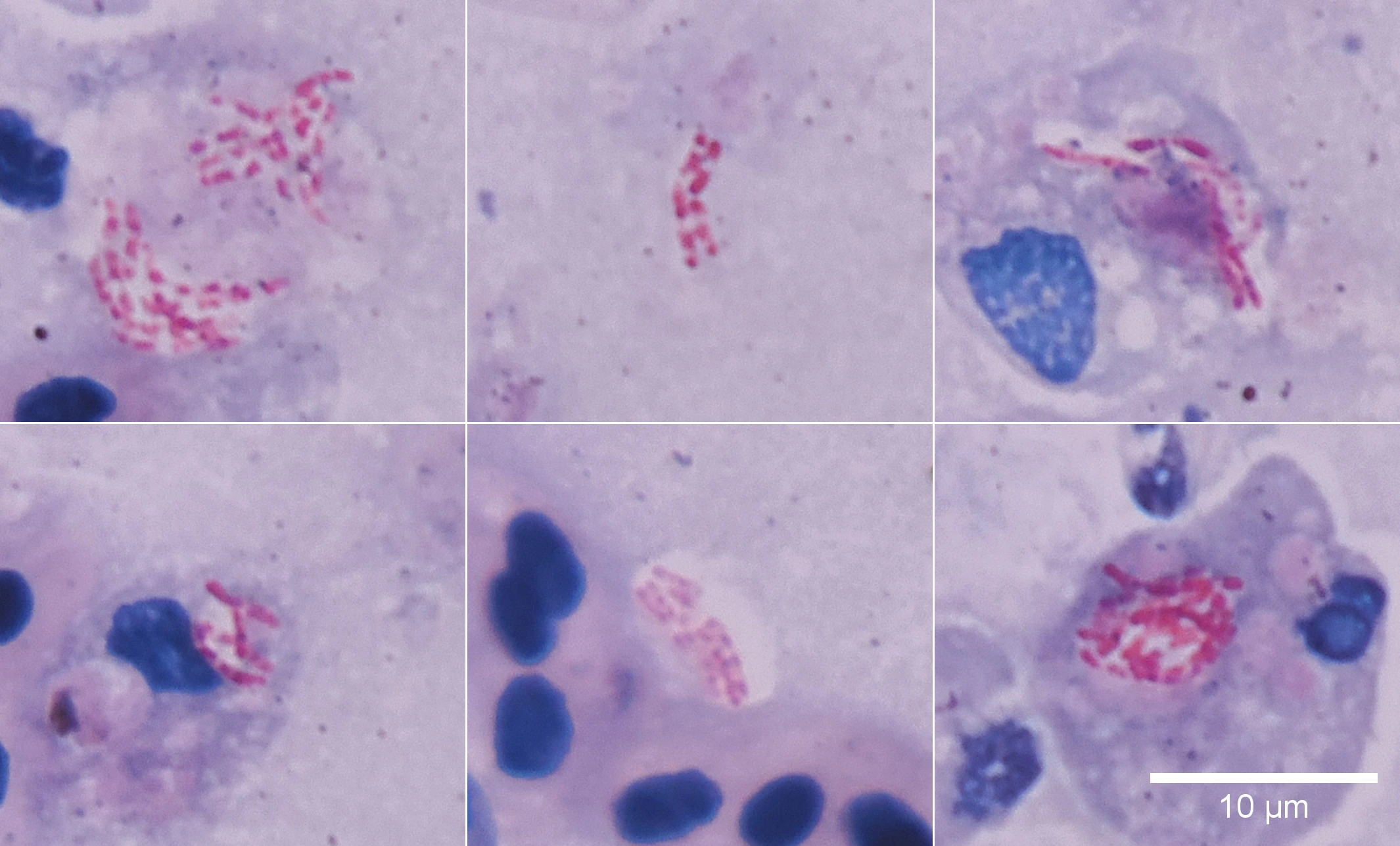 Rod-shaped bacteria stained without phenol, with acid decolorization.