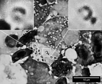 Подковообразные ядра гистиоцитах туловищной почки Chrysiptera cyanea.