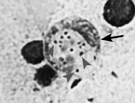 Включения в гистиоците в селезенке Chrysiptera cyanea.